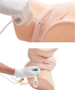 Female Catheterization & Enema Model 2
