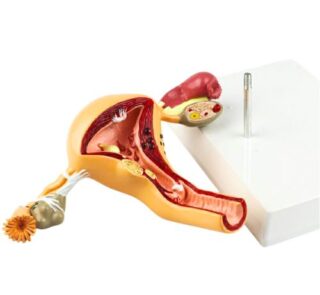 Female Pathological Uterus Anatomy Model 3D 2