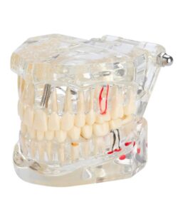 Transparent Anatomical Dental Model 32 Teeth 1