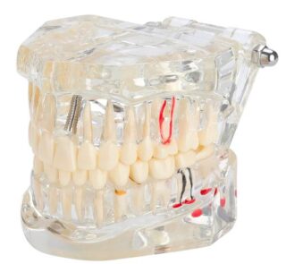 Transparent Anatomical Dental Model 32 Teeth 1