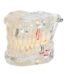 Transparent Anatomical Dental Model 32 Teeth 1