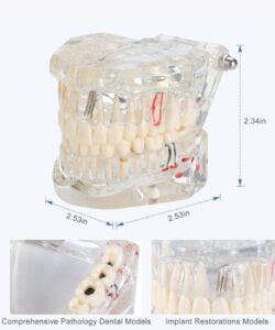 Transparent Anatomical Dental Model 32 Teeth 2