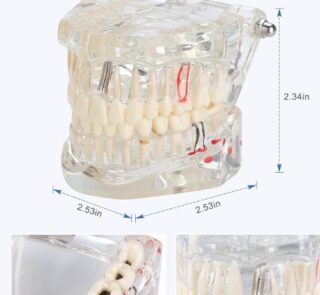 Transparent Anatomical Dental Model 32 Teeth 2