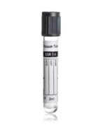 Vacuum ESR Tubes with Sodium Citrate 3.8% 1