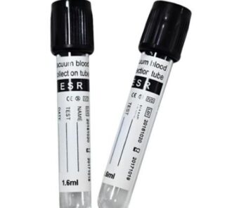Vacuum ESR Tubes with Sodium Citrate 3.8% 2